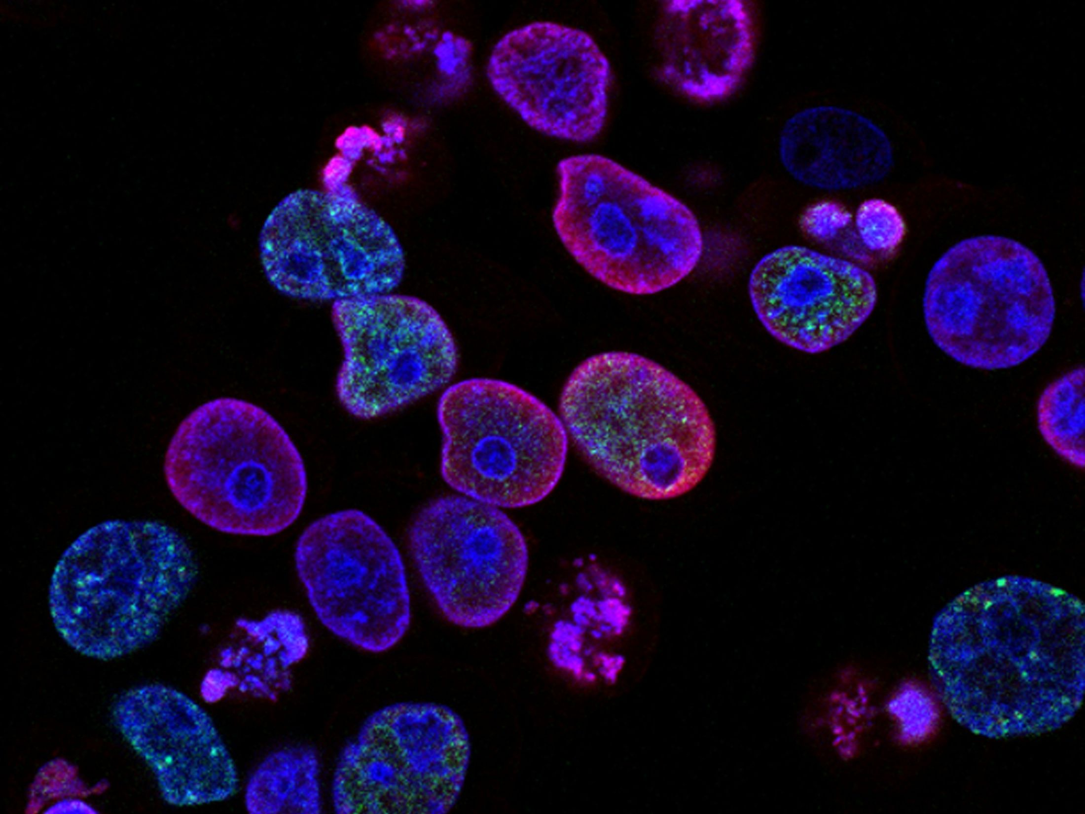 Revolutionizing Pathology: How the PRISM2 Model Transforms Clinical Dialogue into Insightful Slide Interpretations